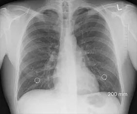 X-ray image